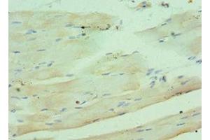 Immunohistochemistry of paraffin-embedded human skeletal muscle tissue using ABIN7148336 at dilution of 1:100 (C1QB 抗体  (AA 104-253))