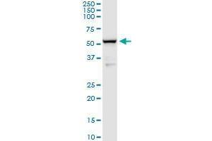 BACE1 monoclonal antibody (M02), clone 2C1. (BACE1 抗体  (AA 22-501))