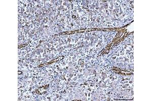 IHC analysis of PTRF/CAVIN1 using anti-PTRF/CAVIN1 antibody (ABIN7601817). (PTRF 抗体  (AA 47-390))
