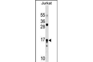 IL17RC Antibody (N-term) (ABIN1538937 and ABIN2850039) western blot analysis in Jurkat cell line lysates (35 μg/lane). (IL17RC 抗体  (N-Term))
