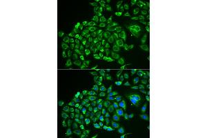 Immunofluorescence analysis of MCF-7 cells using RCVRN antibody. (Recoverin 抗体)