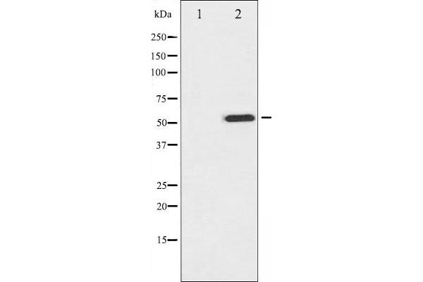 MITF anticorps  (pSer73, pSer180)