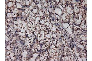 Image no. 7 for anti-V-Akt Murine Thymoma Viral Oncogene Homolog 1 (AKT1) antibody (ABIN1496558) (AKT1 抗体)