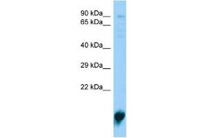 Host:  Rabbit  Target Name:  Pla2g12a  Sample Type:  Rat Spleen lysates  Antibody Dilution:  1. (PLA2G12A 抗体  (Middle Region))