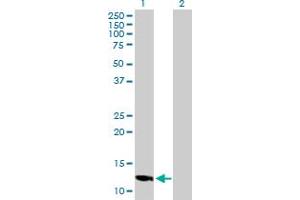 Western Blot analysis of LOC494141 expression in transfected 293T cell line by LOC494141 MaxPab polyclonal antibody. (SLC25A51P4 抗体  (AA 1-154))