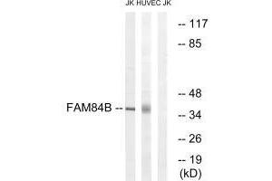 Western blot analysis of extracts from Jurkat cells and HUVEC cells, using FAM84B antibody. (FAM84B 抗体  (N-Term))