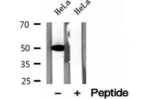 Western blot analysis of extracts of HeLa cells, using GLUD1 antibody. (GLUD1 抗体  (Internal Region))