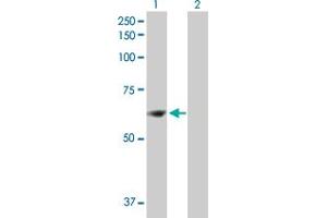 Western Blot analysis of ZNF599 expression in transfected 293T cell line by ZNF599 MaxPab polyclonal antibody. (ZNF599 抗体  (AA 1-588))