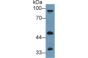 Detection of ALT2 in Human 293T cell lysate using Polyclonal Antibody to Alanine Aminotransferase 2 (ALT2)