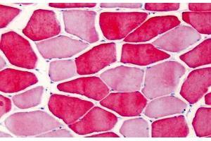 Human Skeletal Muscle: Formalin-Fixed, Paraffin-Embedded (FFPE) (TNNI2 抗体)