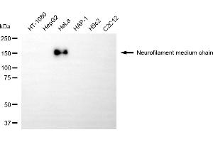 Western blotting analysis using neurofilament medium chain antibody (ABIN7799581).