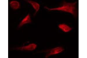 Immunofluorescence (fixed cells) (IF/ICC) image for anti-B-Cell CLL/lymphoma 2 (BCL2) (pSer87) antibody (ABIN6256440)