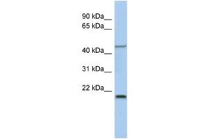 WB Suggested Anti-KLF15 Antibody Titration:  0. (KLF15 抗体  (Middle Region))