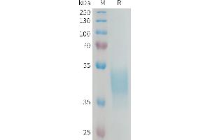 SDS-PAGE (SDS) image for Killer Cell Immunoglobulin-Like Receptor, Two Domains, Long Cytoplasmic Tail, 3 (KIR2DL3) (AA 22-245) protein (His tag) (ABIN7538349)