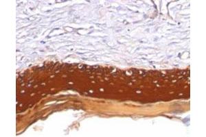 Immunohistochemical staining (Formalin-fixed paraffin-embedded sections) analysis of human skin with Pan Cytokeratin monoclonal antibody, clone AE1 + AE3  at 1:200 using peroxidase-conjugate and DAB chromogen. (Keratin 77 抗体)