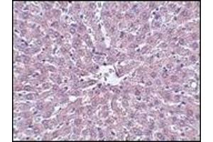 Immunohistochemistry (IHC) image for anti-Interleukin-1 Receptor-Associated Kinase 1 (IRAK1) (AA 618-712) antibody (ABIN492548) (IRAK1 抗体  (AA 618-712))