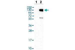 Western blot analysis of Lane 1: Negative control (vector only transfected HEK293T lysate) and Lane 2: Over-expression lysate (Co-expressed with a C-terminal myc-DDK tag (~3. (TAO Kinase 3 抗体  (AA 323-432))