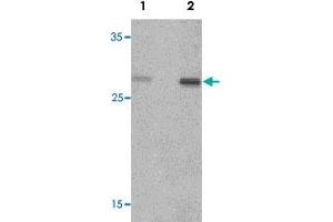 Western blot analysis of rat spleen tissue lysate with CLEC7A polyclonal antibody  at (1) 1 and (2) 2 ug/mL. (CLEC7A 抗体  (Internal Region))
