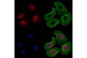 ABIN6263656 and ABIN6277487 staining Hela cells by IF/ICC. (Nemo-Like Kinase 抗体  (N-Term))