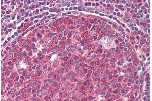 Human Tonsil (formalin-fixed, paraffin-embedded) stained with CD19 antibody ABIN462310 followed by biotinylated goat anti-rabbit IgG secondary antibody ABIN481713, alkaline phosphatase-streptavidin and chromogen.