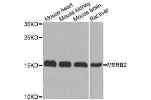 Western blot analysis of extracts of various cell lines, using MSRB2 antibody. (MSRB2 抗体  (AA 10-182))