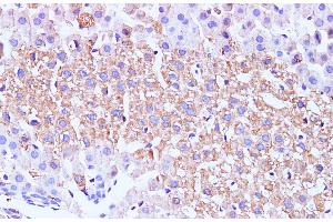 Immunohistochemistry of paraffin-embedded Mouse liver using GCK Polyclonal Antibody at dilution of 1:100 (GCK 抗体)