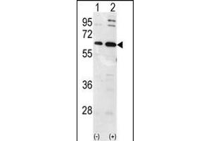 Western blot analysis of Ubiquilin1 (arrow) using Ubiquilin1 Antibody (N-term) (ABIN388965 and ABIN2837880). (Ubiquilin 1 抗体  (N-Term))