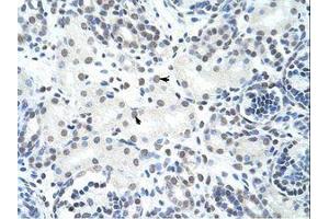 Image no. 1 for anti-Heterogeneous Nuclear Ribonucleoprotein H3 (2H9) (HNRNPH3) (AA 51-100) antibody (ABIN203064) (HNRNPH3 抗体  (AA 51-100))