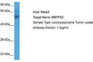 Host:  Rabbit  Target Name:  MBTPS2  Sample Tissue:  Human Leiomyosarcoma Tumor lysates  Antibody Dilution:  1ug/ml (MBTPS2 抗体  (N-Term))