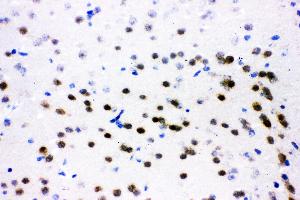 Immunohistochemistry (IHC) image for anti-Activating Transcription Factor 2 (ATF2) (AA 93-450) antibody (ABIN3043791)