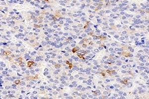 Immunohistochemistry analysis of paraffin-embedded rat pituitary using,CHST8 (ABIN7073301) at dilution of 1: 3000 (CHST8 抗体)