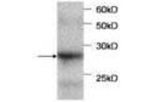 Image no. 1 for anti-serpin Peptidase Inhibitor, Clade B (Ovalbumin), Member 4 (SERPINB4) antibody (ABIN791514)