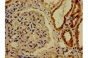 Immunohistochemistry of paraffin-embedded human kidney tissue using ABIN7148855 at dilution of 1:100 (CDK13 抗体  (AA 1-170))