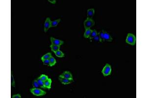 Immunofluorescent analysis of HepG2 cells using ABIN7149599 at dilution of 1:100 and Alexa Fluor 488-congugated AffiniPure Goat Anti-Rabbit IgG(H+L) (DOCK7 抗体  (AA 1440-1671))