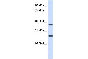 FAM156A antibody used at 1 ug/ml to detect target protein. (FAM156A 抗体  (N-Term))