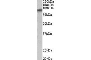 Western Blotting (WB) image for anti-Zinc Finger Protein 652 (ZNF652) (C-Term) antibody (ABIN2464976) (ZNF652 抗体  (C-Term))