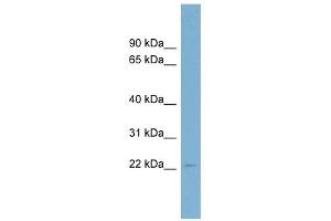 C15ORF15 antibody used at 1 ug/ml to detect target protein. (RSL24D1 抗体  (Middle Region))