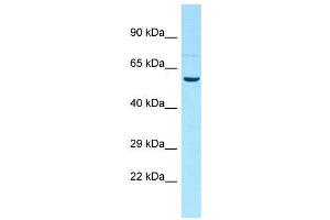 Host:  Rabbit  Target Name:  Ddx19b  Sample Type:  Rat Testis lysates  Antibody Dilution:  1. (DDX19B 抗体  (N-Term))