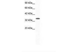 Image no. 1 for anti-Aryl Hydrocarbon Receptor Interacting Protein (AIP) (AA 99-148) antibody (ABIN202263) (AIP 抗体  (AA 99-148))