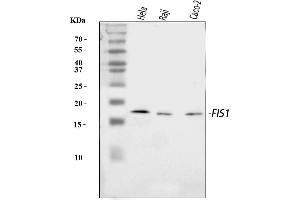 Western blot analysis of TTC11/FIS1 using anti-TTC11/FIS1 antibody (ABIN7600321).