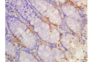 Immunohistochemistry (Paraffin-embedded Sections) (IHC (p)) image for anti-Interleukin 1 Receptor, Type II (IL1R2) (AA 301-398) antibody (ABIN747758)