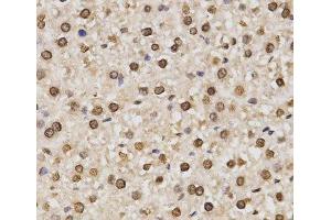 Immunohistochemistry of paraffin-embedded Rat liver using DiMethyl-Histone H3-K14 Polyclonal Antibody at dilution of 1:200 (40x lens). (Histone 3 抗体  (2meLys14))