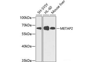 Western blot analysis of extracts of various cell lines using METAP2 Polyclonal Antibody at dilution of 1:1000. (METAP2 抗体)