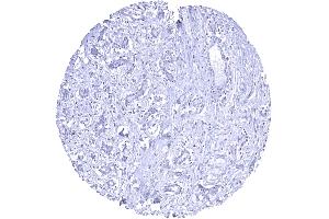 Breast HER2 staining is lacking in normal breast in case of appropriate formalin fixation (Recombinant ErbB2/Her2 抗体  (Extracellular Domain))