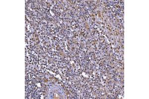 IHC analysis of TOP3B using anti-TOP3B antibody (ABIN7599907). (TOP3B 抗体  (AA 128-824))