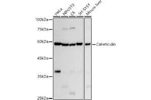 Western blot analysis of extracts of various cell lines, using Calreticulin antibody (ABIN7266042) at 1:1000 dilution. (Calreticulin 抗体)