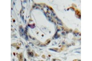 IHC-P analysis of Pancreas tissue, with DAB staining. (PPY 抗体  (AA 30-87))