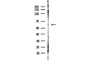 anti-Makorin Ring Finger Protein 1 (MKRN1) antibody