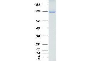 Validation with Western Blot