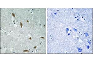 Immunohistochemical staining of paraffin-embedded human brain tissue reacted with AKT1/AKT3 (phospho Y437/Y434) polyclonal antibody  at 1:50-1:100 dilution. (AKT1/3 (pTyr437), (Tyr434) 抗体)